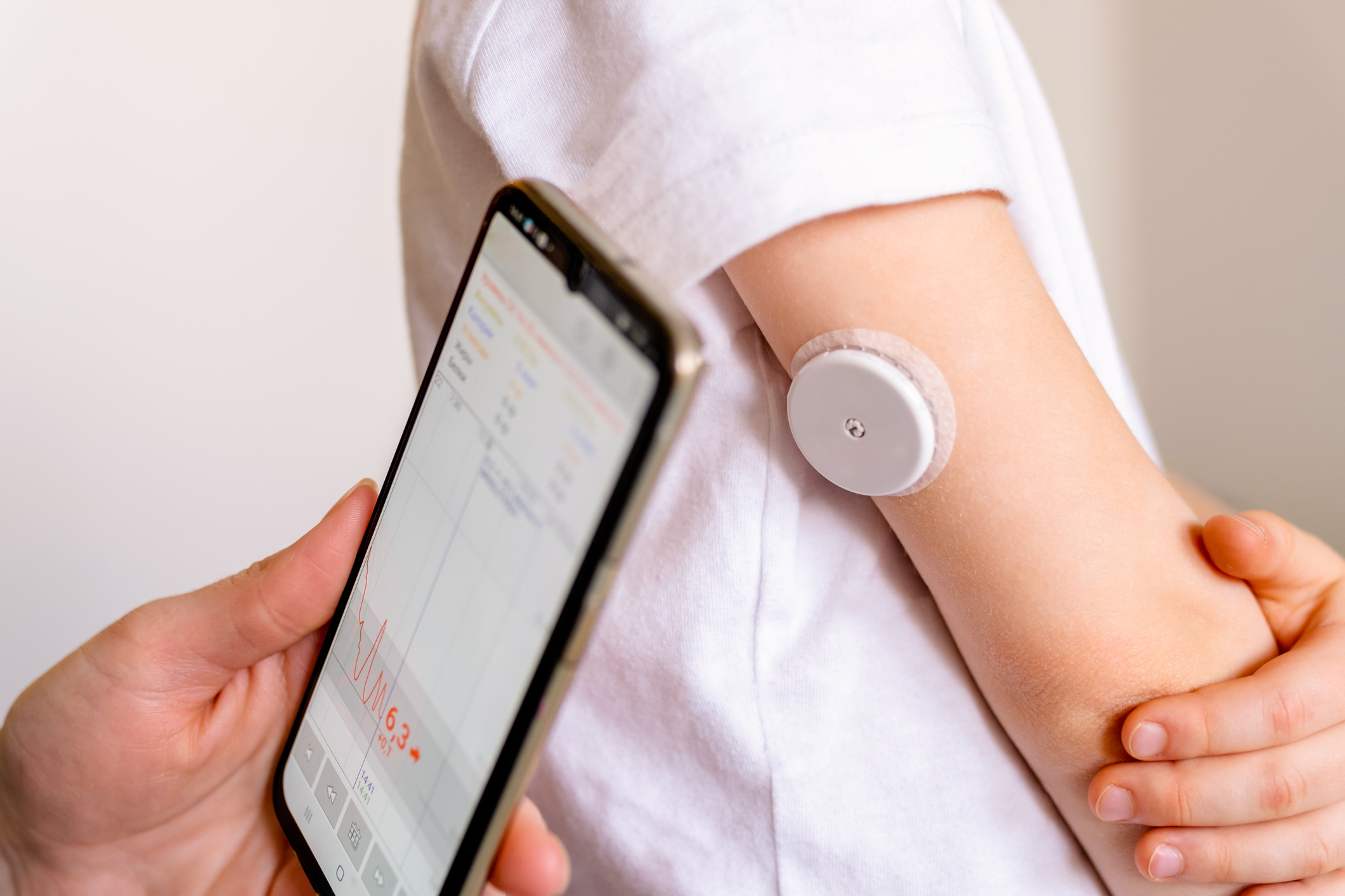 Abbott, DexCom và Apple: Từ cộng sinh thành cạnh tranh
